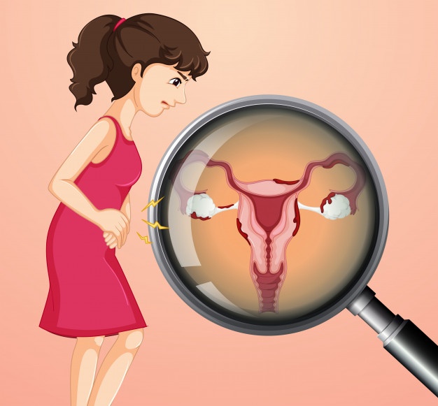cervical cancer screening